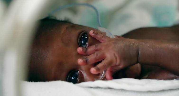 Premature baby